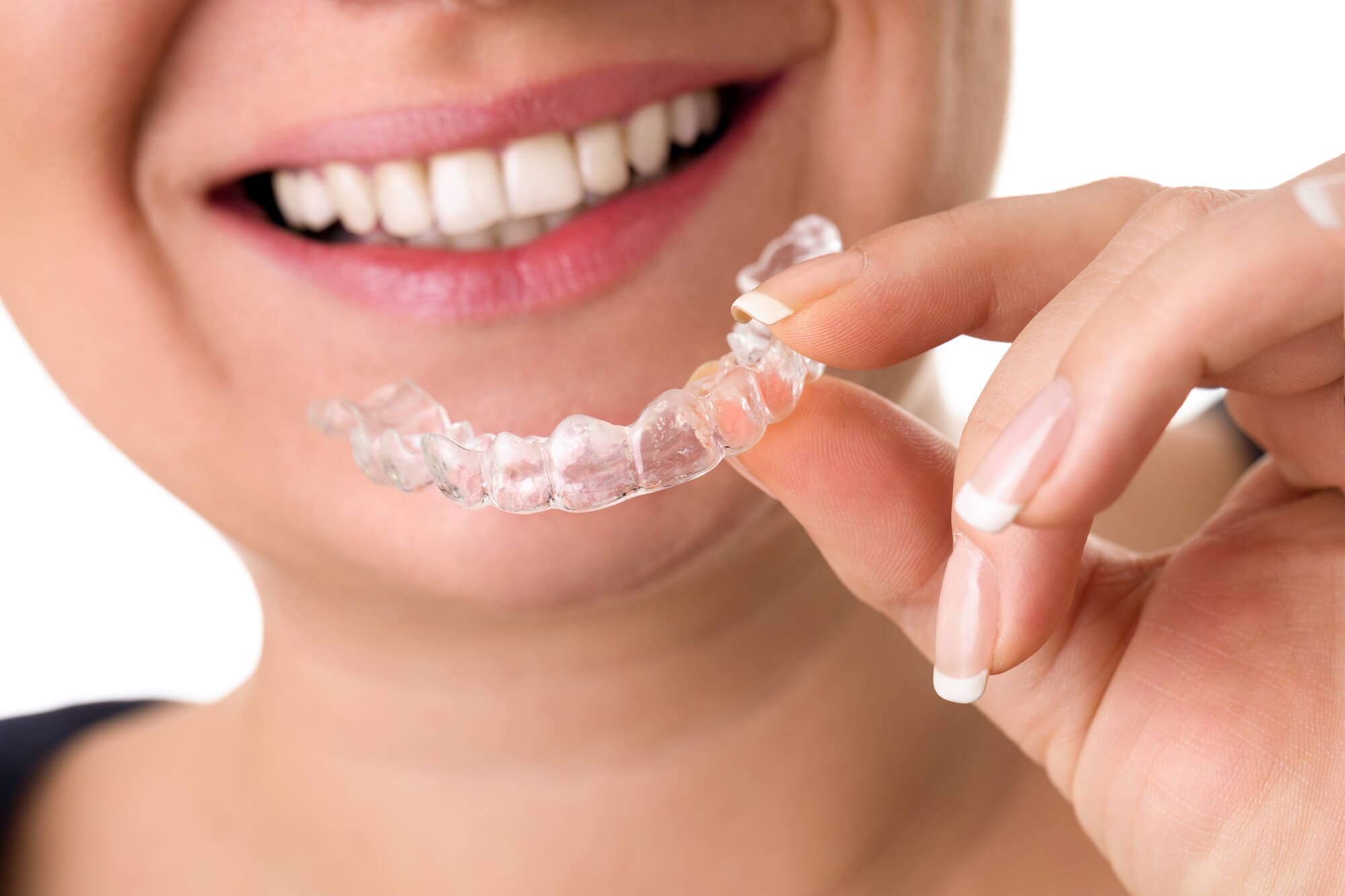 Women smiling with straight teeth