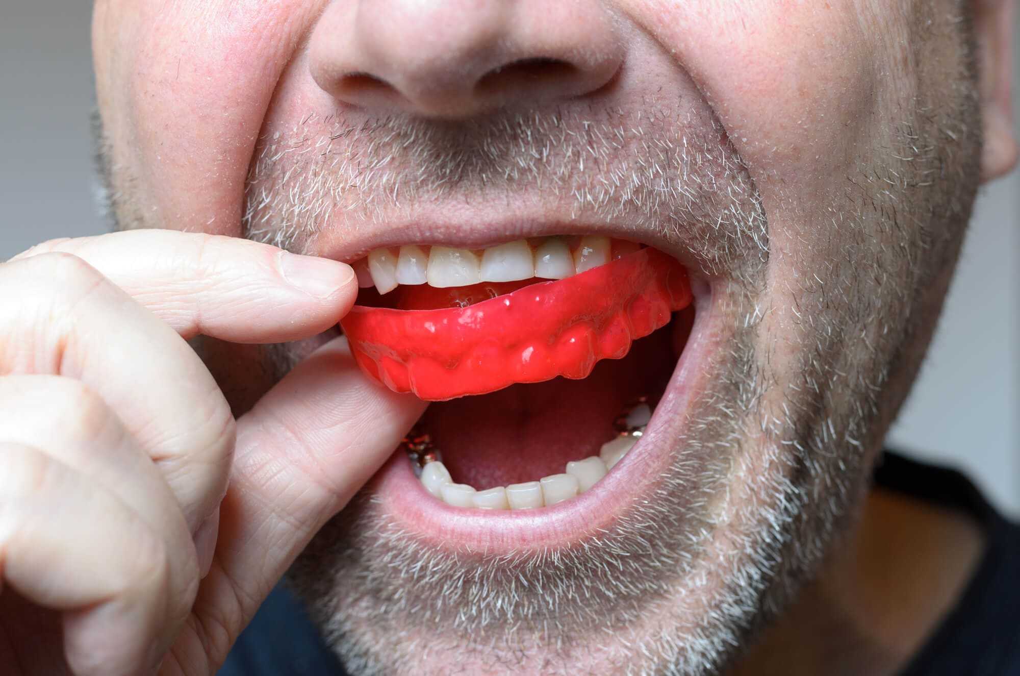 man putting on mouth guard
